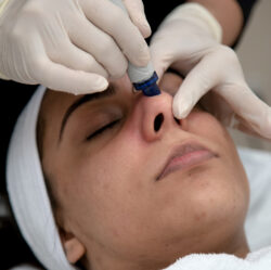 Youthful Glow with Anti-Ageing Injectables