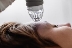 Fractional RF Microneedling for Skin Firming: How Dubai Locals Achieve Youthful Skin