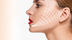 How Long Does HIFU Last? Understanding Results and Care