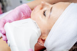 Your Guide to HIFU: Lifting and Tightening Skin Effectively