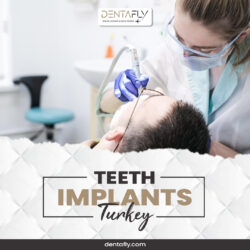 Affordable Teeth Implants in Turkey – Trusted Dental Implants at DentaFly