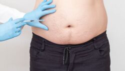 Experience Fast Fat Loss with Fat Melting Injections in Dubai