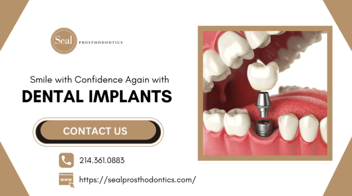 A Lasting Solution for Missing Teeth