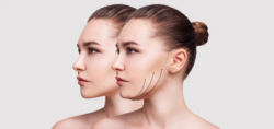 What Happens During a Double Chin Liposuction Procedure?