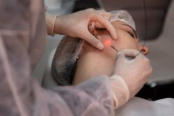 Endolift: Non-Surgical Skin Tightening