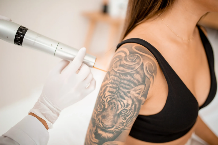 Transform Your Skin with Fast, Effective Laser Tattoo Removal!
