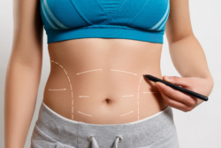 Wedding Prep in Dubai: Try Laser Liposuction