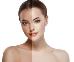 Cold Peel for Urban Skin