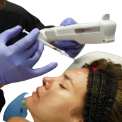 Everything You Need to Know Before Getting Botox