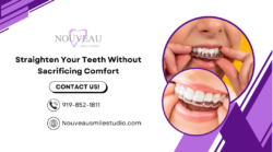 Feel Confident Again with Invisalign Aligners