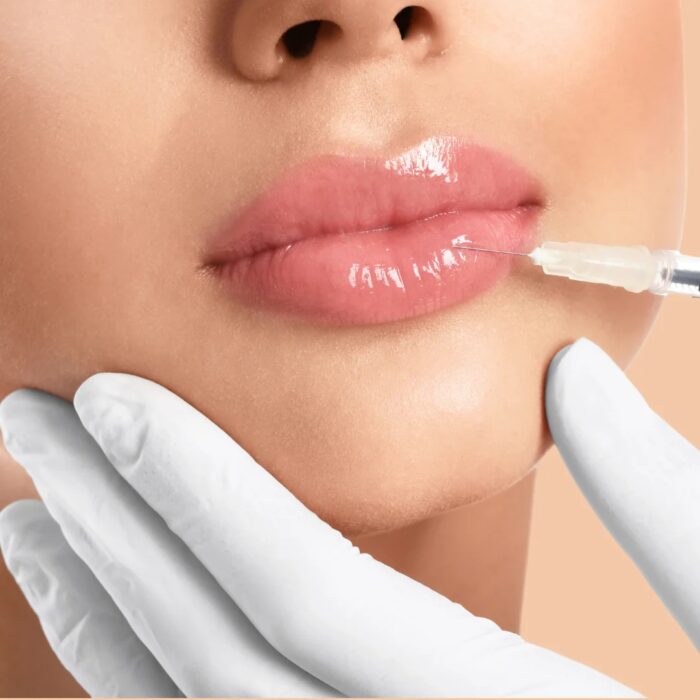 Juvederm Fillers: Safety Basics