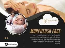 Morpheus8 Face