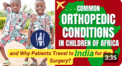 Common Orthopedic Conditions in Children of Africa
