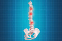 India vs Canada for Disc Replacement Surgery: A Patient’s Guide to Making the Right Choice
