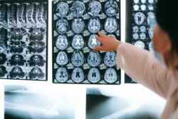 Comparing Neurosurgery in India and the United Kingdom: Access, Cost, and Quality