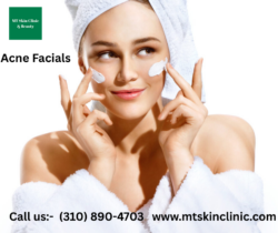 Acne Facials | Clear, Heal, and Restore Troubled Skin