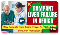 Rampant Liver Failure in Africa | Why Patients Travel to India for the Liver Transplant