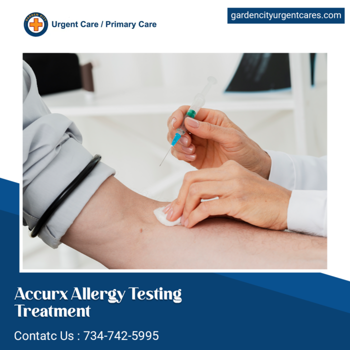 Accurx Allergy Testing Treatment