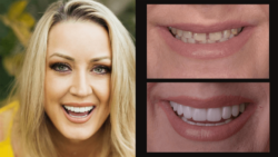 Transform Your Smile with Cosmetic Dentistry in Arlington