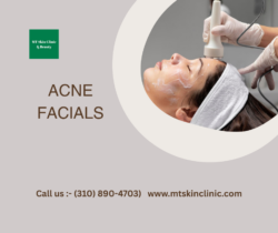 Acne Facials at MT Skin Clinic – Clear, Healthy Skin Care