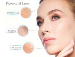 Advice before and after Picosecond Laser
