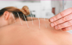 Healing Naturally: How Acupuncture Supports Effective Pain Management