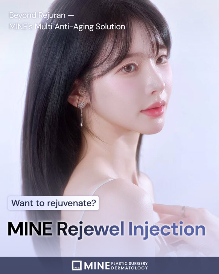 Introducing MINE Rejewel Injection