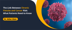 Colon Cancer Doctor in Kolkata | Dr. Azhar Alam