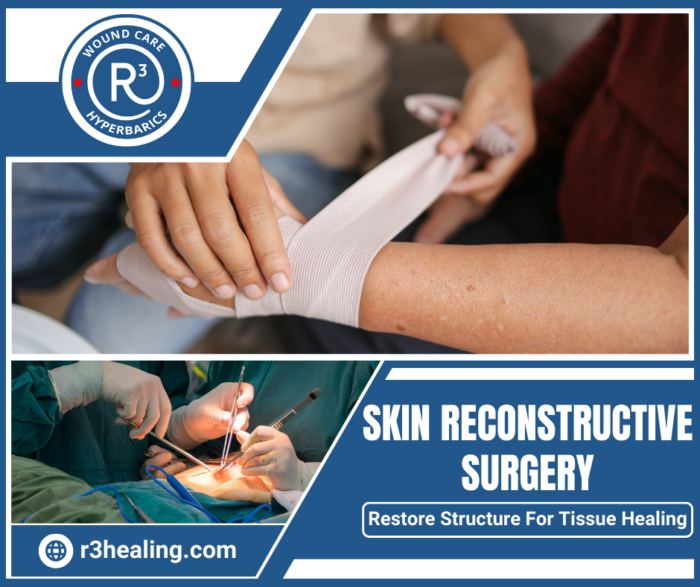 Skin Reconstructive Surgery Solutions