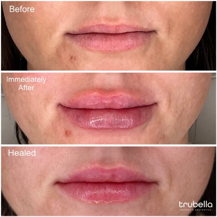 Injectables MA