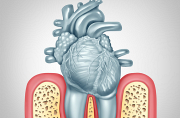 Gum Disease Treatment Melbourne CBD – Expert Care