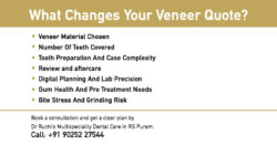 What Affects the Cost of Dental Veneers?