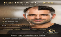 Best Hair Transplant in Rajkot | Cost & Price Info – Clion Care