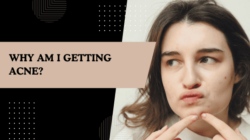 Why am I getting acne? Face areas, causes & dermatologist treatments