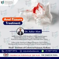 Best Treatment for fissure in kolkata |Dr. Azhar Alam