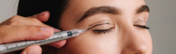 Upper Blepharoplasty in Cape Town for Brighter, Youthful Eyes