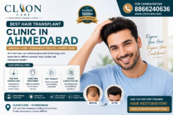 best hair transplant in gujarat