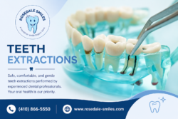 Professional Teeth Extractions Procedure at Modern Dental Clinic