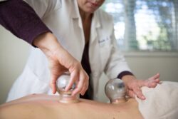 Cupping Therapy