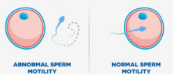 Semen Analysis Test Near Me