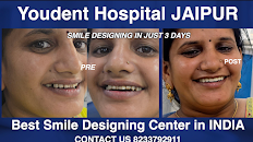 Best Dentist in Jaipur
