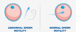 Clia sperm test austin texas