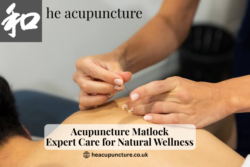 Acupuncture Matlock – Natural Wellness & Expert Care