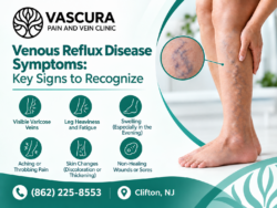 Venous Reflux Disease: Symptoms, Causes & Warning Signs