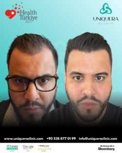UniquEra Clinic – Hair Transplant Clinic in Istanbul, Turkey